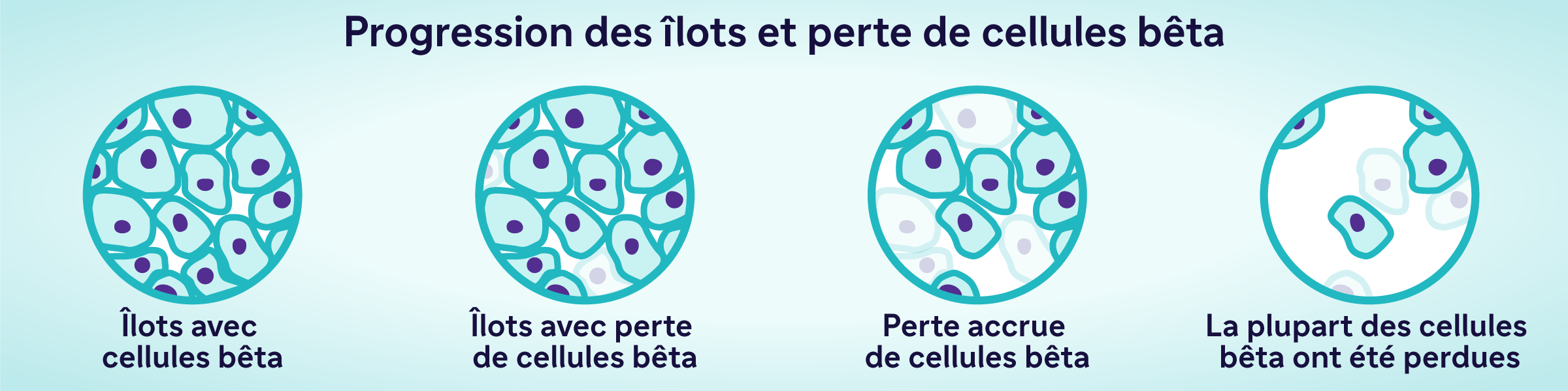 Progression des îlots et perte de cellules bêta :•	Îlots avec cellules bêta•	Îlots avec perte de cellules bêta•	Perte accrue de cellules bêta•	La plupart des cellules bêta ont été perdues